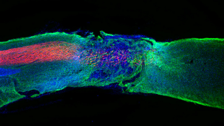 Regenerálódott axonok a sérült gerincvelőben