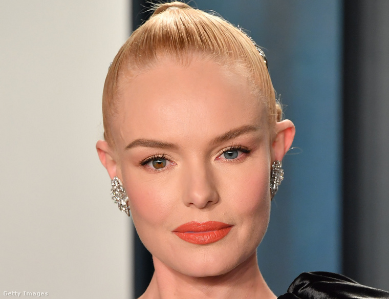 Kate Boshworth-nek heterokrómiája van