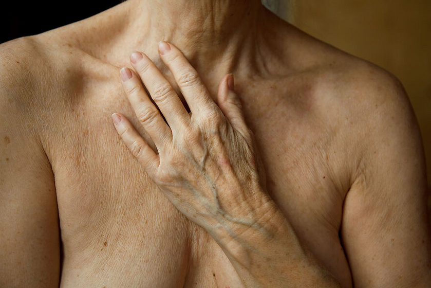 Marna Clarke Megöregedni címet viselő képe megmutatja, milyen is egy gyönyörű, idősödő nő teste a valóságban közelről, retus nélkül. Ritkán látni ilyen felvételt.