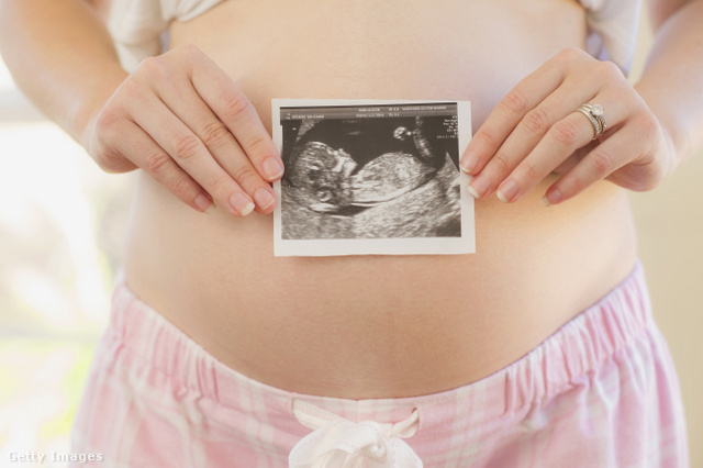 A mióma megfelelő kezelése mellett a terhesség is megvalósítható