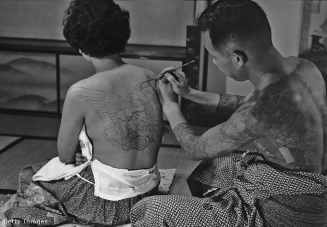 1955, előrajzolás. Ma a tű egyórás kezelés alatt 180 000 lyukat üt a bőrön