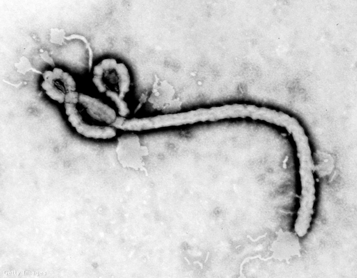 A CDC mikrobiológusa, Frederick A Murphy által készített transzmissziós elektronmikroszkópos felvétel (TEM) az Ebola-vírusról 1976-ban