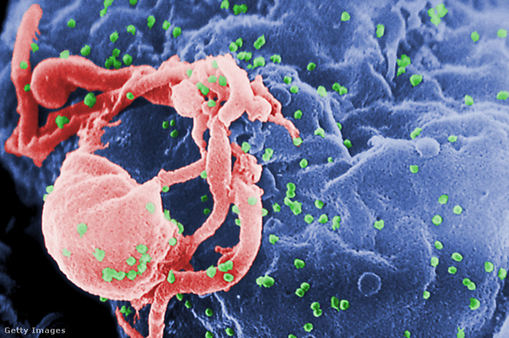 HIV-vírus elektronmikroszkópos felvételen