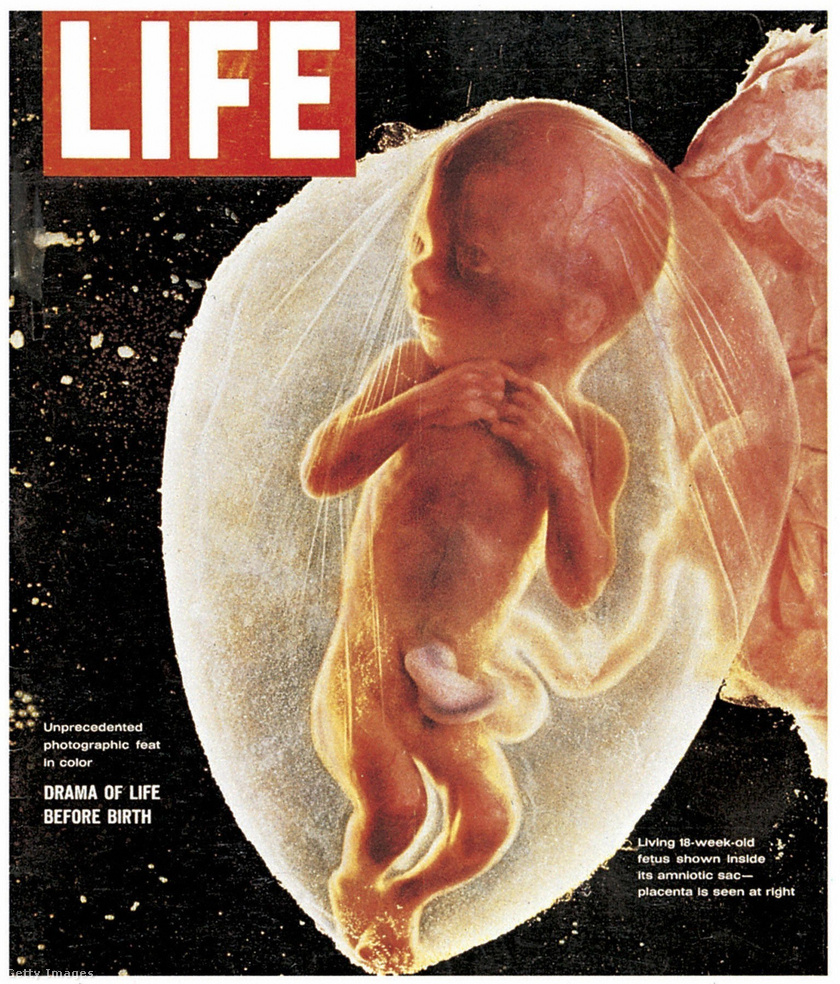 Az emlékezetes, Foetus 18 Weeks című címlapfotó