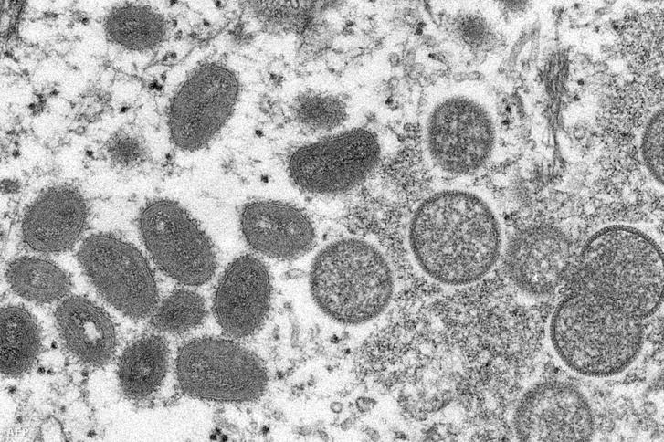 Elektronmikroszkópos kép a majomhimlő vírusról