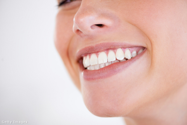 A fogak fehérítése nem csak fogkrémmel történhet