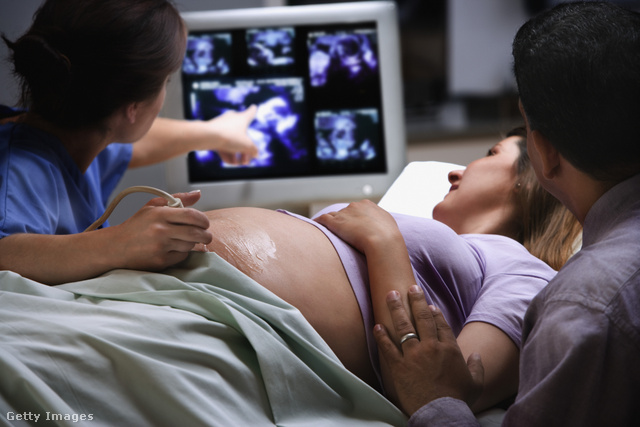 A várandósgondozás során is előfordulhatnak kellemetlen helyzetek egy idősebb nőnél, akárcsak a szülésnél