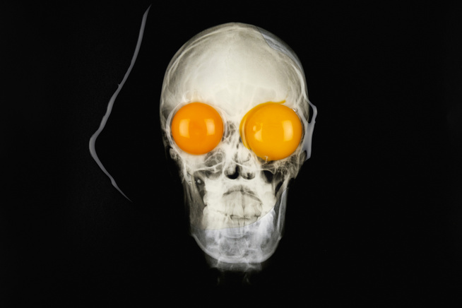 Vajon a tojás jó az agynak?