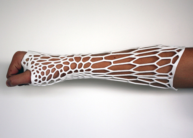 dezeen Cortex-3D-printed-cast-for-broken-bones-by-Jake-Evill-2