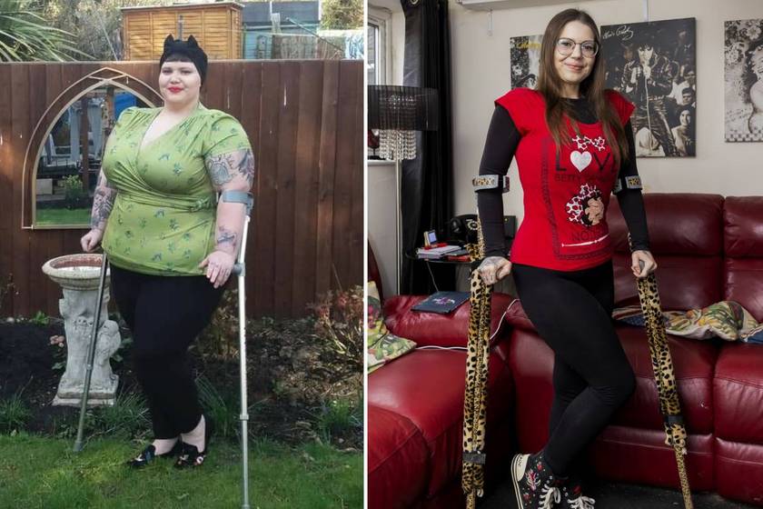 Jess Gould összesen 91 kilót fogyott életmód-változtatásának köszönhetően. Az egykor 153 kilós nő, aki 54-es méretű ruhákat hordott, két év alatt 61 kilóra lefogyott, és ruhatárát már 36-os méretű darabokra cserélte. Fibromyalgiát, azaz izomrostfájdalmat okozó betegséget állapítottak meg nála, amit nem tudtak volna kezelni anélkül, hogy lefogyna.