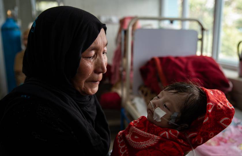 Alultáplált kisgyermek egy kabuli gyerekkórházban.