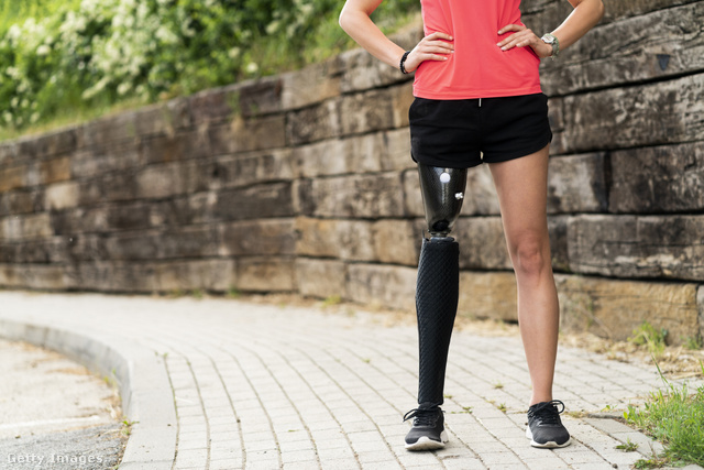 A lábprotézis már nem fért bele az esélyegyenlőségi kampányba