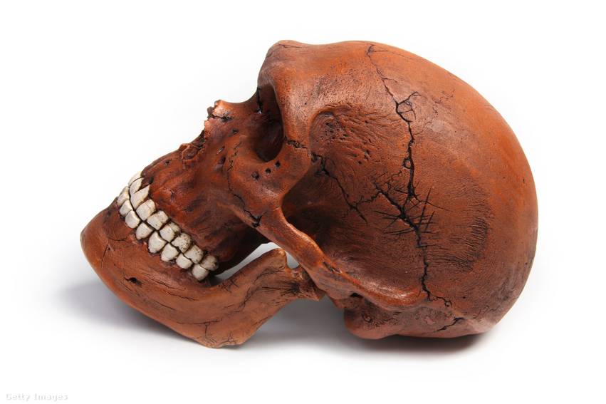 A Neander-völgyi ember valószínűleg nem szenvedett ennyit fogfájástól
