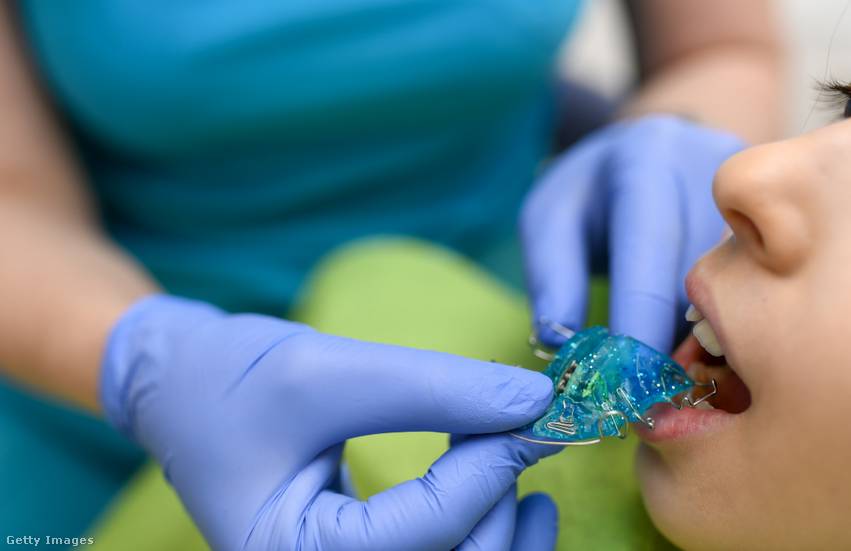 Csak a szabályos fogsor teszi lehetővé a fogazat könnyű tisztítását és az egyszerű szájhigiénét. Sok fájdalomtól óv meg minket