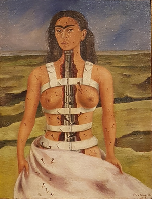 Frida Kahlo testi kínjait festményein is megörökítette