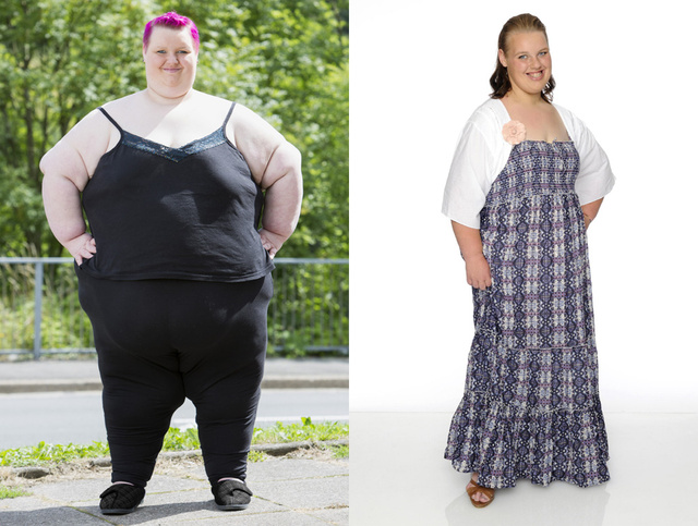 114 kilótól szabadult meg a kövér brit tini