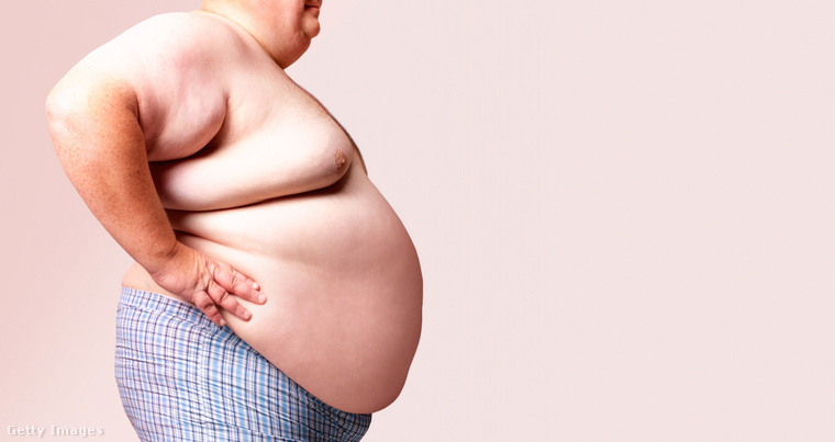 Az elhízás a helytelen táplálkozás miatt is kialakulhat. (Fotó: Peter Dazeley / Getty Images Hungary)