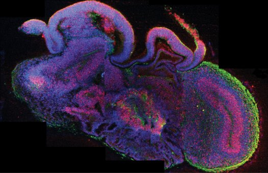 A mesterséges agyról készült 3D-s felvételen felismerhetők a különböző agyterületek