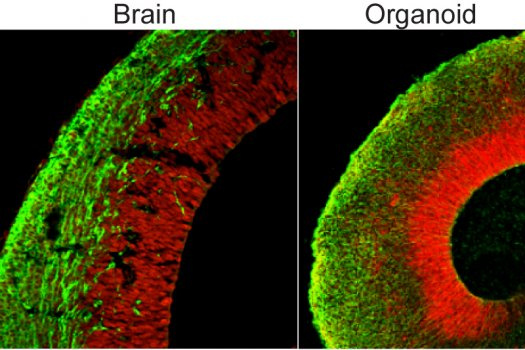 Egy fejlődésben lévő egér agya (balra) és a mesterségesen előállított organoid (jobbra)