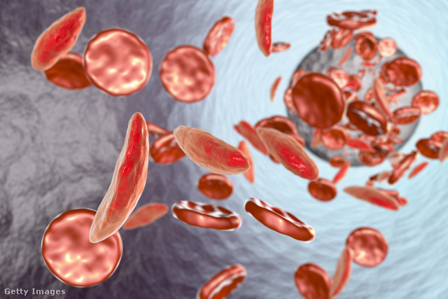 A vas fontos alkotóeleme a vér hemoglobinjának, amely megköti és elszállítja az oxigént a sejtekhez
