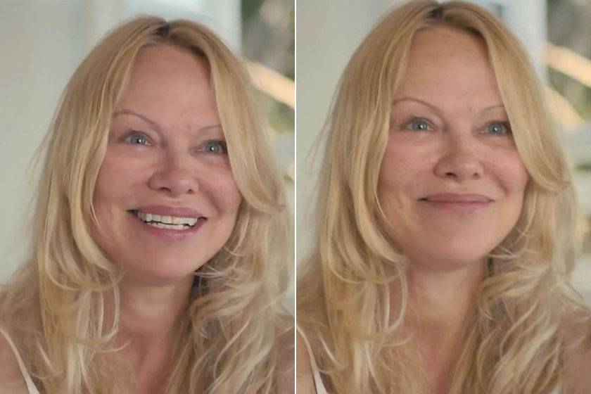 Pamela Anderson bevállalta, hogy teljesen natúr arccal álljon kamerák elé.