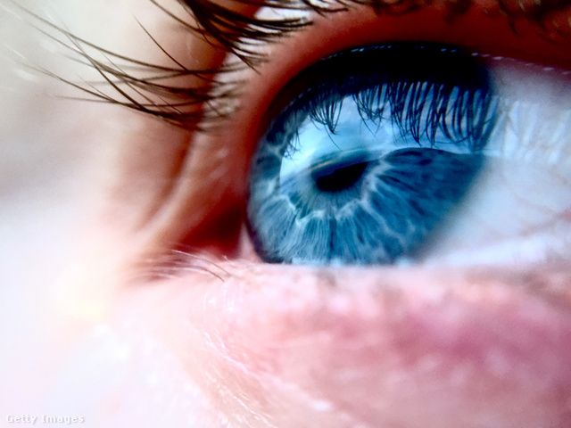 Ha kék a szemed, kevésbé kell tartanod a vitiligótól