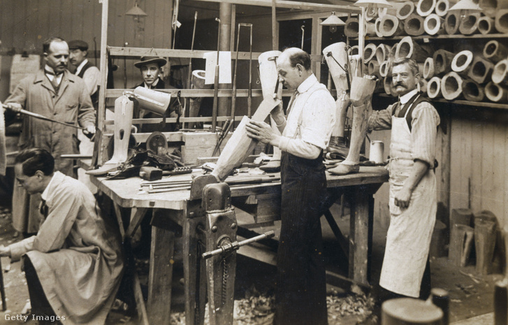 Művégtagokat készítenek a Queen Mary's Hospital ápoltjai számára az első világháború után