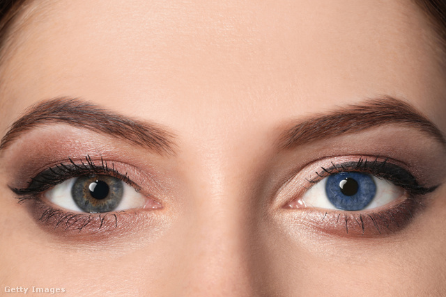 A heterokrómia egy ritka rendellenesség, melynek hatására a két szem írisze különböző színű lehet
