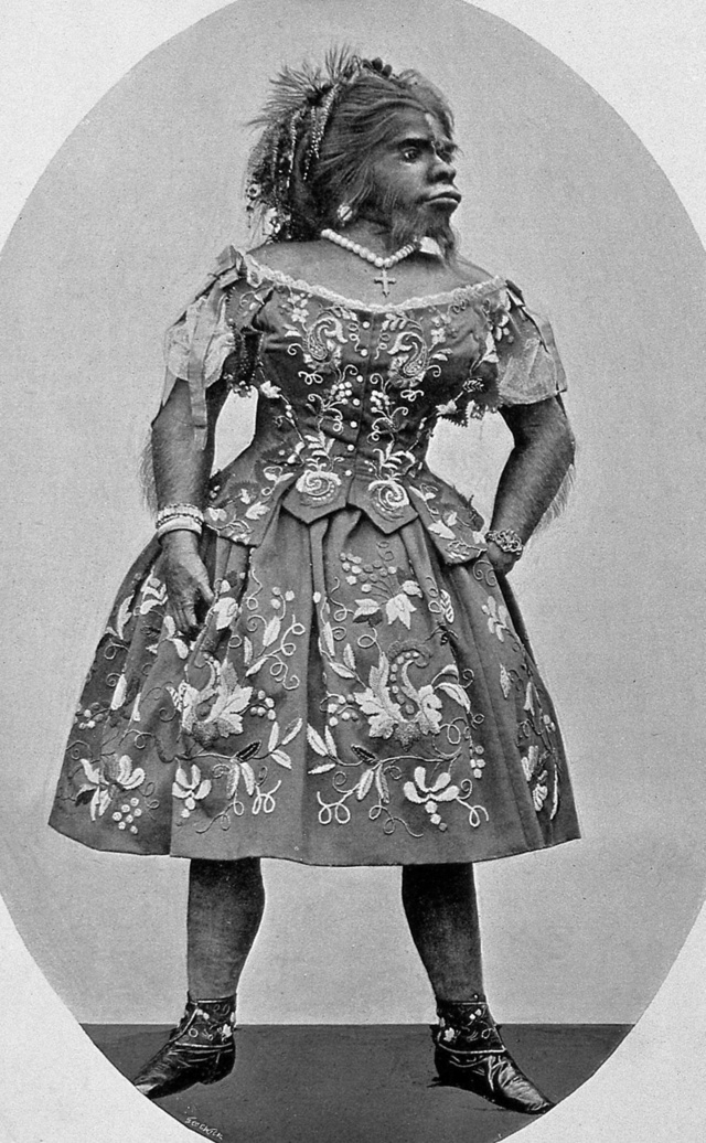 Julia Pastrana (1834–1860), a „kutyafejű” mexikói énekesnő