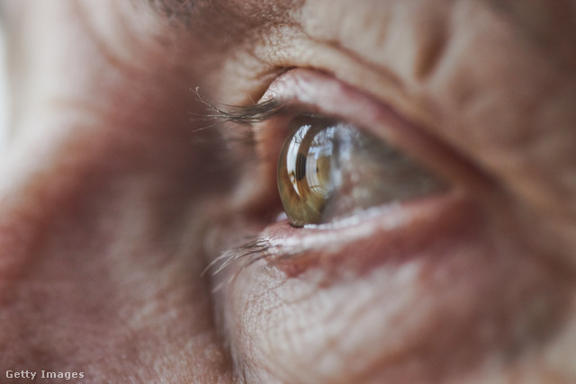 Az időskori látásvesztés egyre több embert érint világszerte