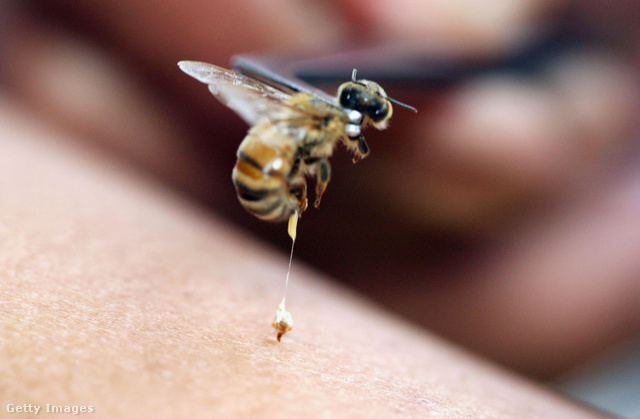 A rovarcsípések közül a méh szúrása igen veszélyes, mert mérget lövell a bőrünkbe
