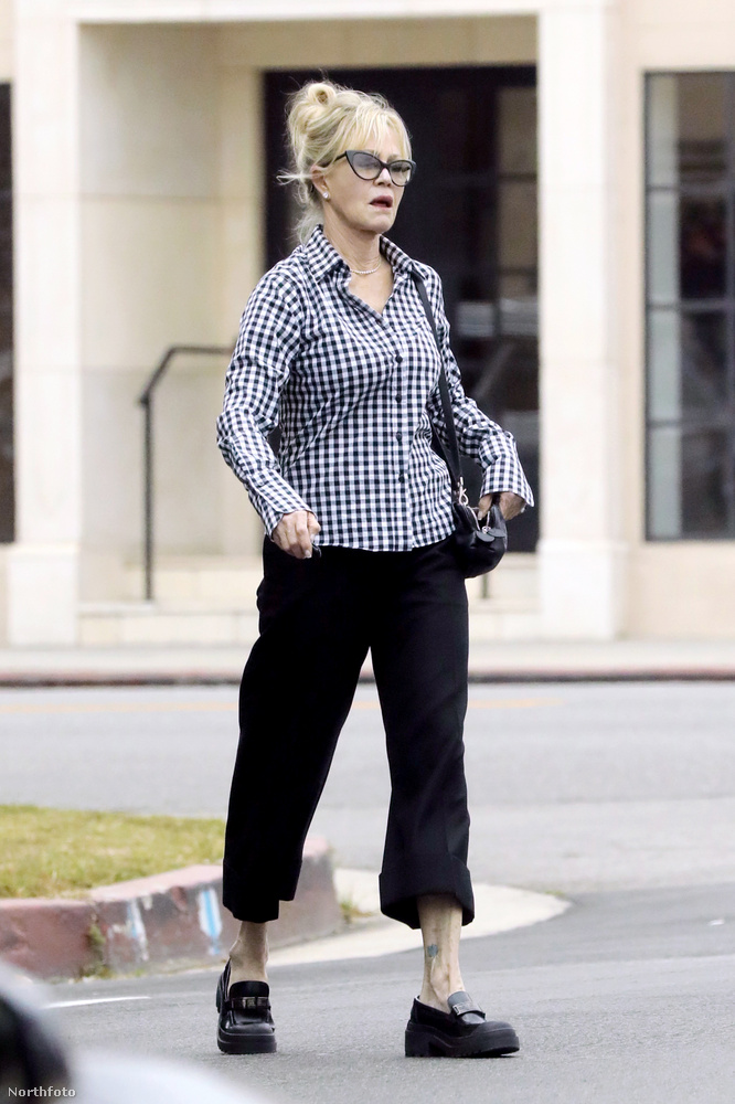 Az Oscar-díjra jelölt Melanie Griffith egy feltűnő nagy heggel a bal arcfelén lépett ki péntek délután az utcára