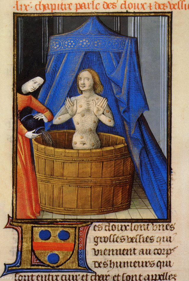 Bőrbetegség gyógyítása forró fürdővel a 15. században
