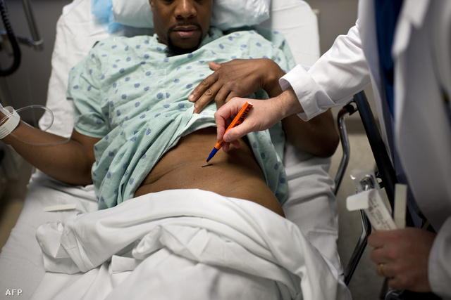A donor vese helyét jelöli meg az orvos szervkivétel előtt, Johns Hopkins Kórház, Baltimore.