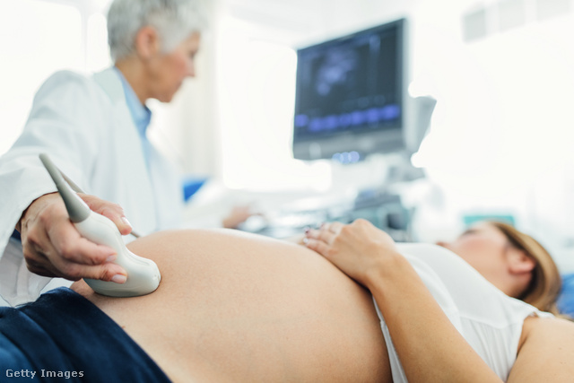 Gyakran csak a hasi ultrahangon lehet hallani a baba szívhangját