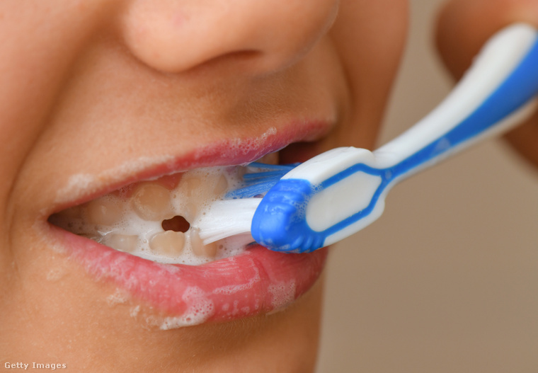 Amennyiben hosszú időn keresztül nem mos fogat, akkor hosszú távon olyan komoly egészségügyi kockázatokkal nézhet szembe, mint a cukorbetegség, a vakság vagy akár a stroke. (Fotó: picture alliance / Getty Images Hungary)