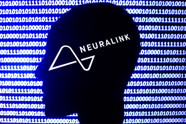 A Neuralink már májusban megkapta a szükséges engedélyeket az agyi bavatkozásokhoz. (Fotó: NurPhoto / Getty Images Hungary)