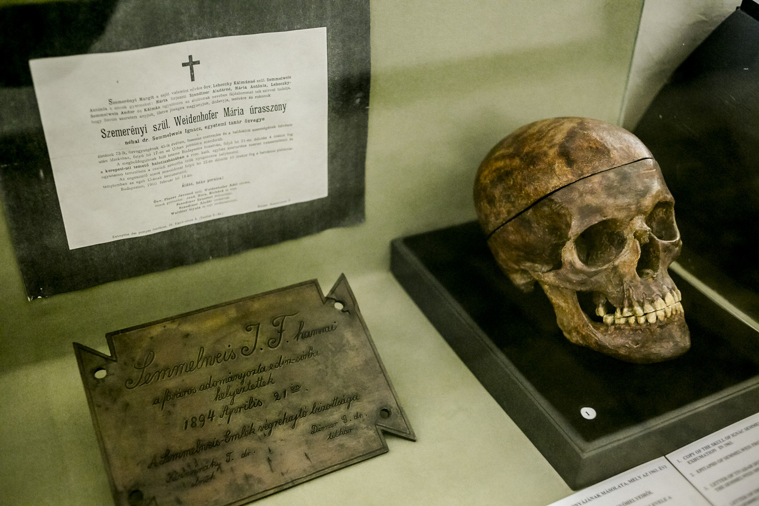 Semmelweis koponyájának másolata