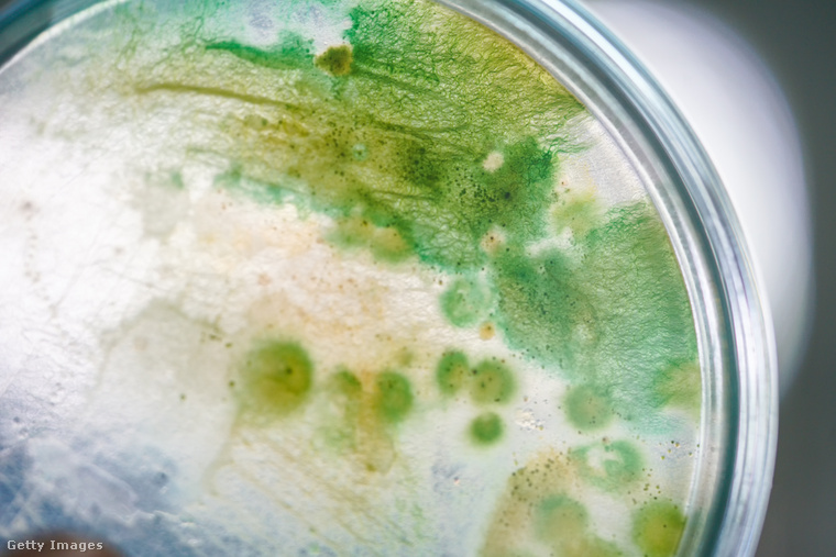 Tengeri alga mikroszkóp alatt. (Fotó: tonaquatic / Getty Images Hungary)