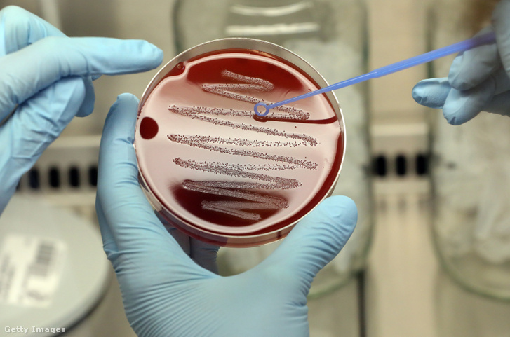 Streptococcus pyogenes-törzs baktériumtelep egy vér-agar lemezen