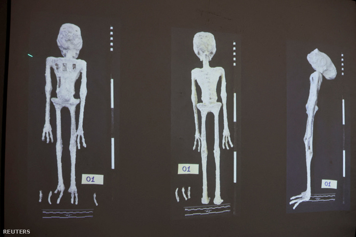 Egy röntgenfelvételen mutatják be a Perui Jogi Orvostudományi Intézet kutatói az „idegen múmiákról” végzett tanulmányt Limában, Peruban 2024. január 12-én