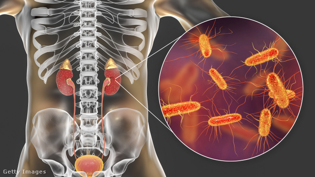 A súlyos megbetegedést okozó rezisztens baktériumok szinte bárhol megbújhatnak az emberi testben