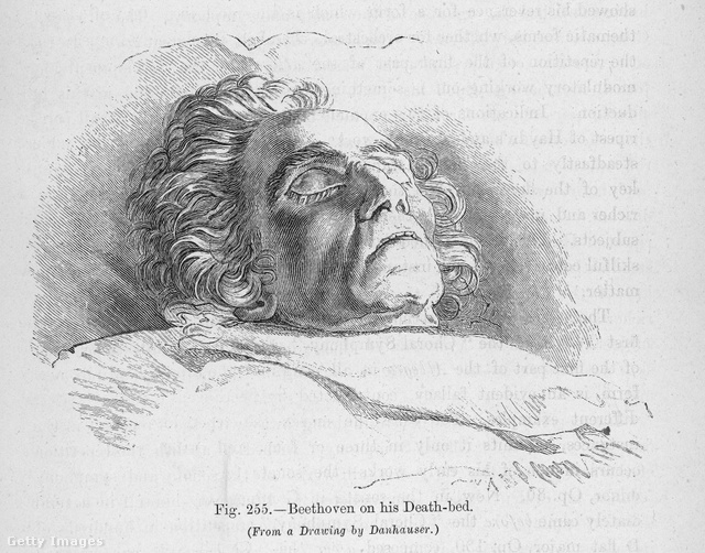 Ez a korabeli rajz a halálos ágyán fekvő Beethovent ábrázolja: nem akarta, hogy titok maradjon az emberek előtt, amitől szenvedett