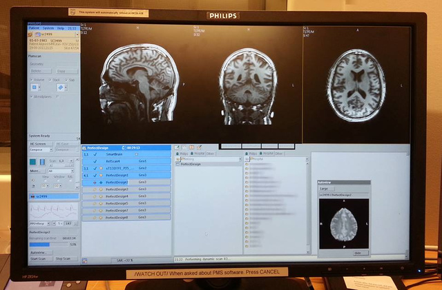 A marketingesek legújabb nagyágyúja az MRI szkenner
