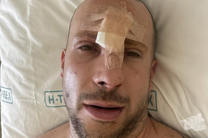 Beck Renátót az ultrák olyan súlyosan megtámadták, hogy hétfőn műtéti beavatkozást kellett rajta végrehajtani (Fotó: ugytudjuk.hu)