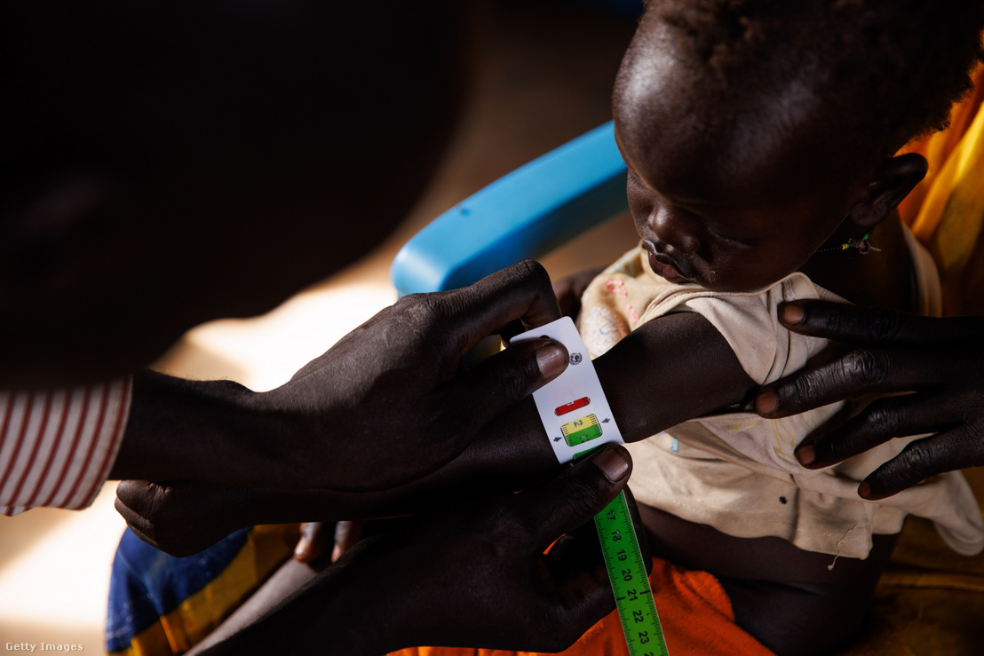 Egy kislányt az édesanyja visz be egy klinikára MUAC-mérésre 2023. november 29-én a dél-szudáni Rotriakban