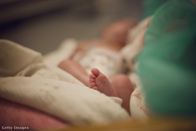 Élettani szülés vagy császármetszés: nem mindegy, hogy zajlik az az első találkozás
