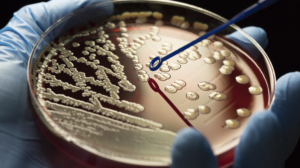 Emberi vérre szomjazó halálos baktériumokat fedeztek fel tudósok