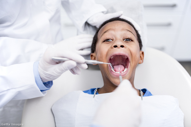 Sokan még mindig félnek a fogorvostól, noha erre nincs valódi indok. (Fotó: Science Photo Library / Getty Images Hungary)