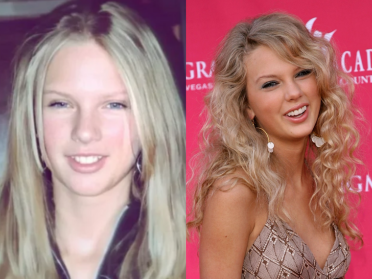 Taylor SwiftAz énekesnő fiatalon sokat küzdött fogaival, azonban 2006-ban az első albumának megjelenése után megcsináltatta mosolyát.